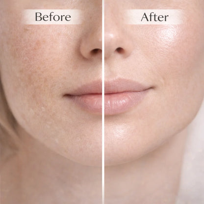 Before-and-after skin comparison graphic for Cuvelle balm